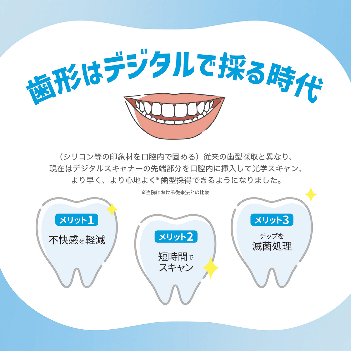 Aoralscan Elite IPG口腔内スキャナの紹介バナー